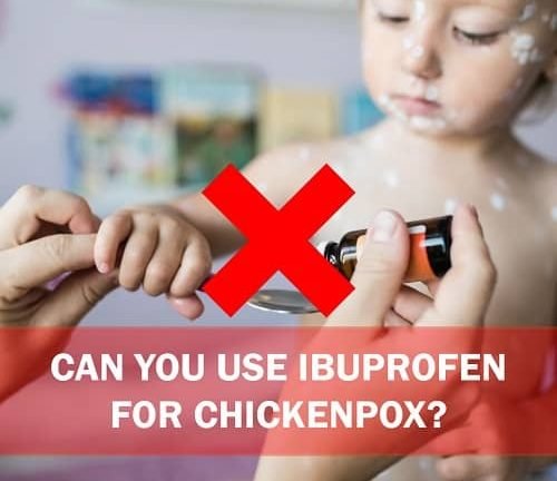 Can you use ibuprofen for chickenpox? Short answer: NO.